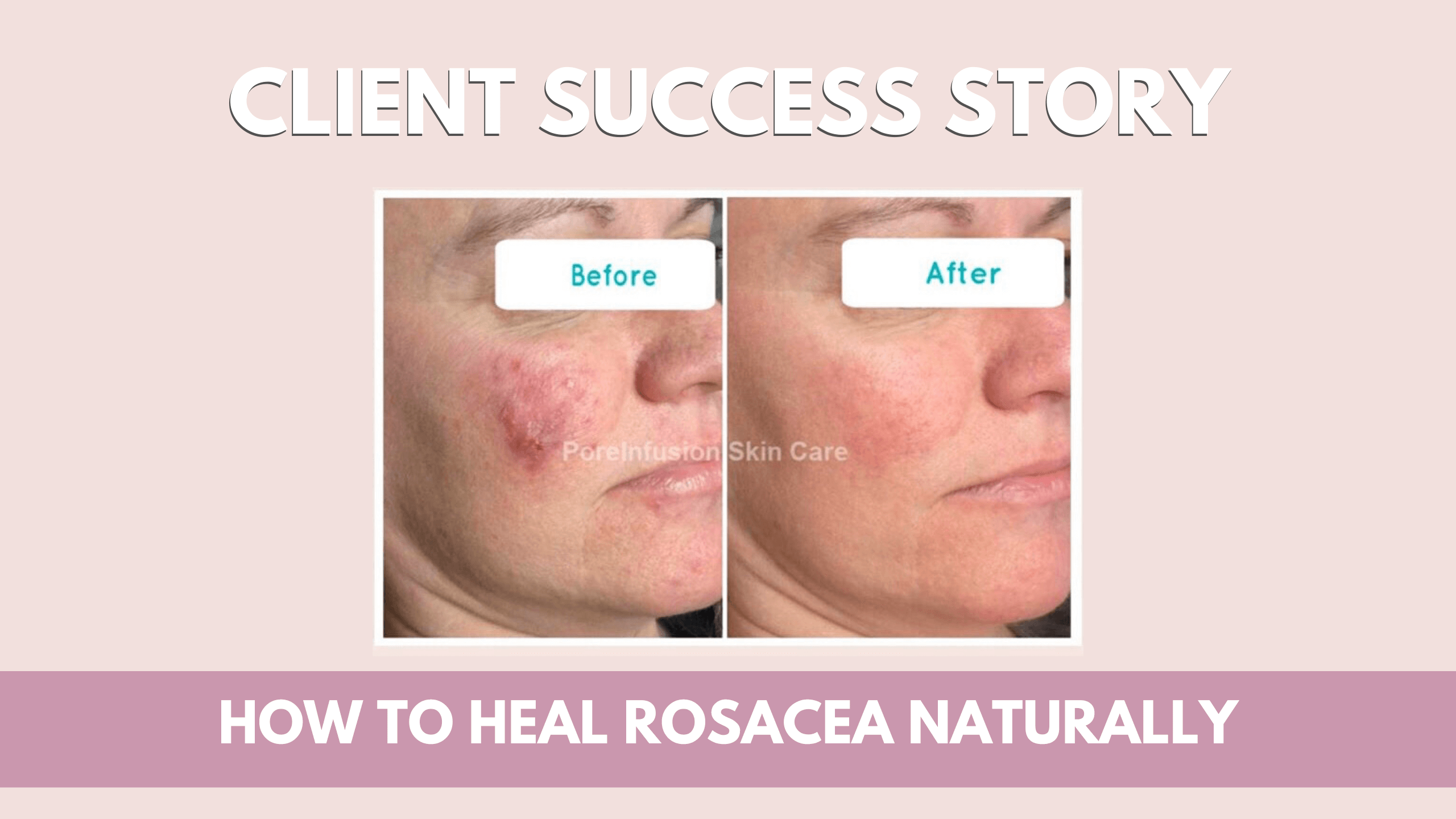 Pore Infusion Acne & Skin Care - Youtube graphics